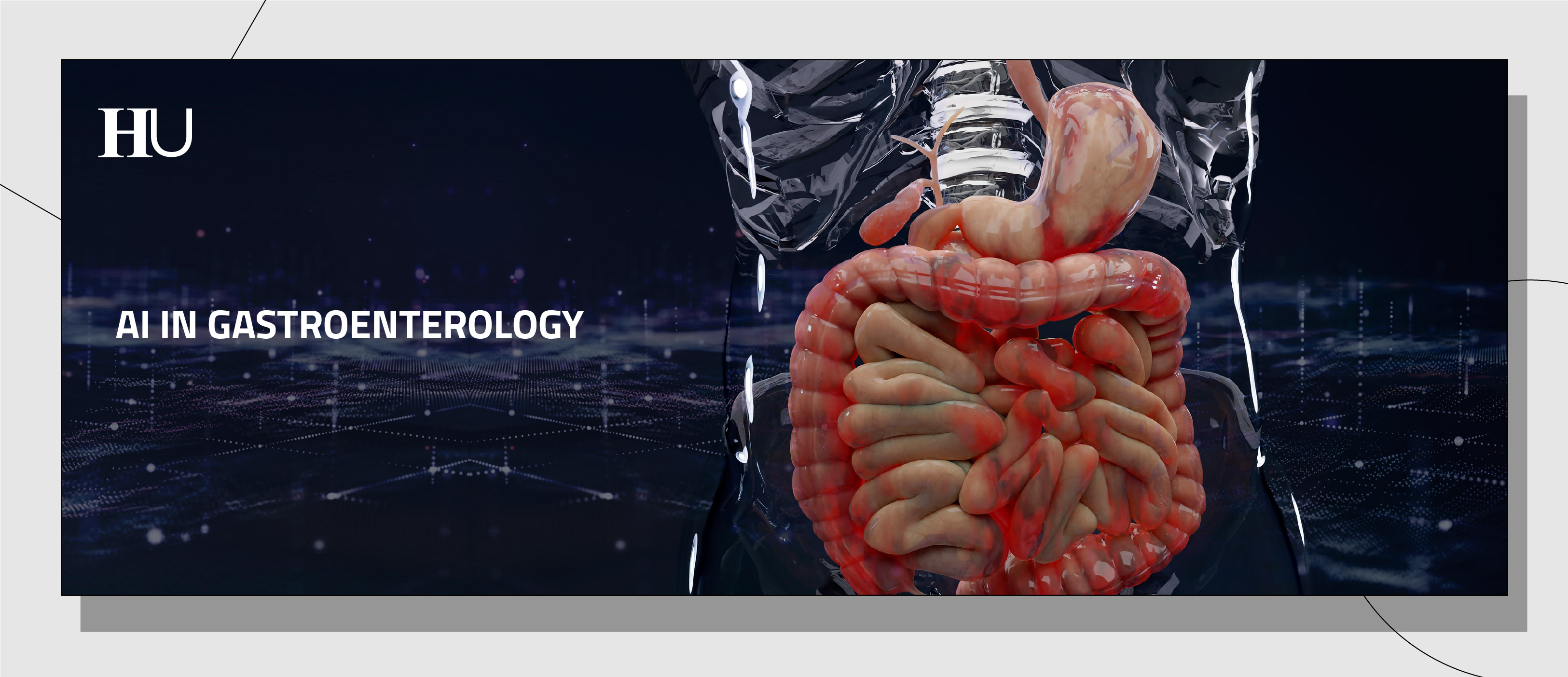 AI in Gastroenterology